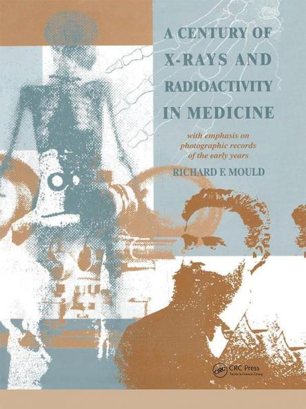 A Century of X-Rays and Radioactivity in Medicine