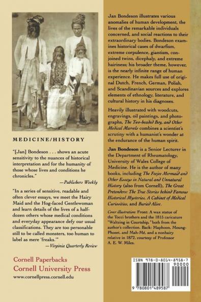 Two-Headed Boy and Other Medical Marvels