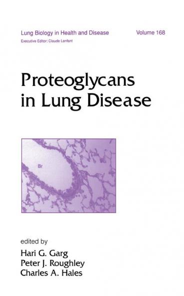 Proteoglycans in Lung Disease
