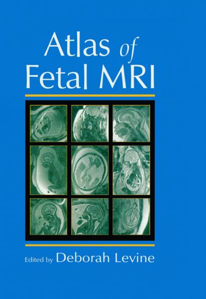 Atlas of Fetal MRI
