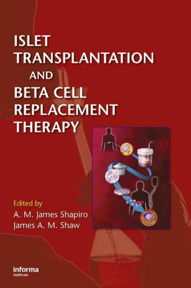Islet Transplantation and Beta Cell Replacement Therapy