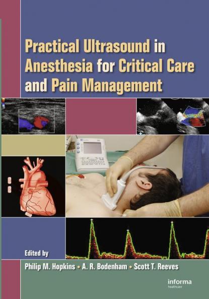 Practical Ultrasound in Anesthesia for Critical Care and Pain Management