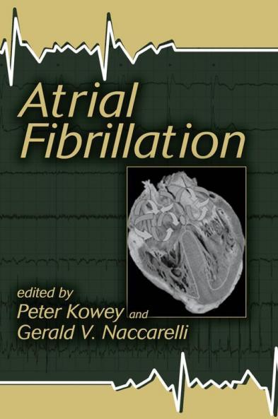 Atrial Fibrillation