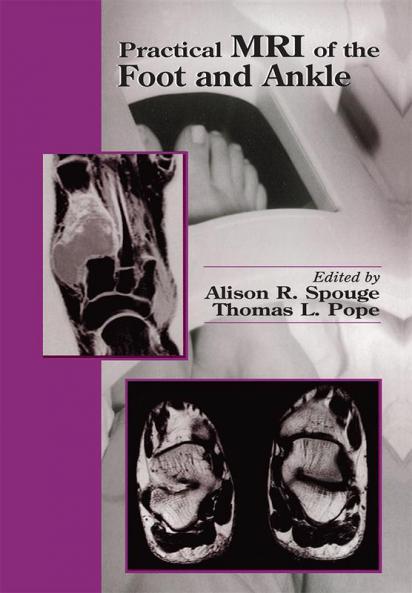Practical MRI of the Foot and Ankle