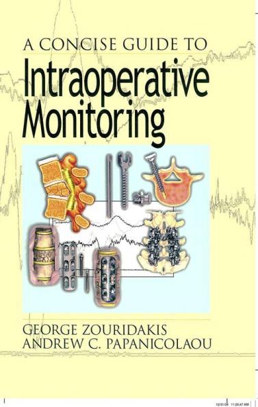Concise Guide to Intraoperative Monitoring