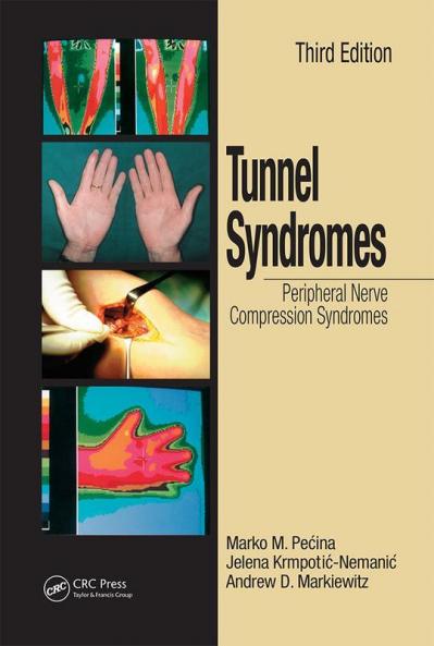 Tunnel Syndromes