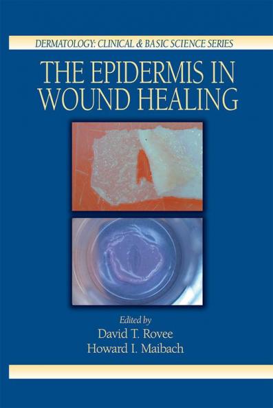 Epidermis in Wound Healing