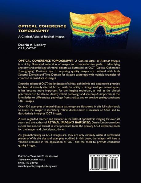 Optical Coherence Tomography a Clinical Atlas of Retinal Images