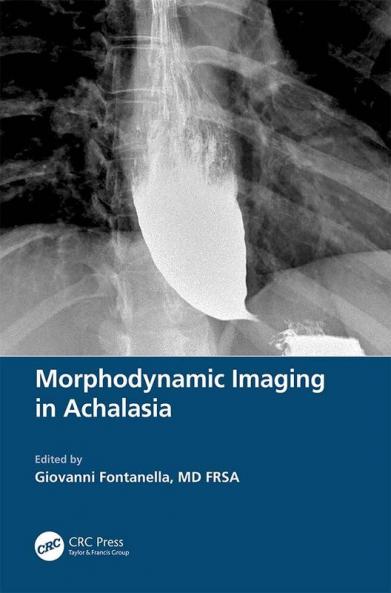 Morphodynamic Imaging in Achalasia