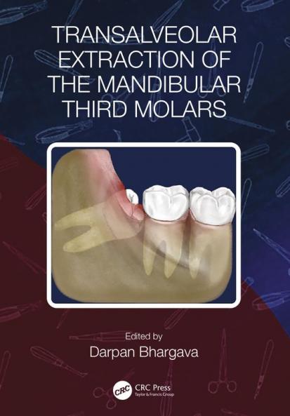 Transalveolar Extraction of the Mandibular Third Molars