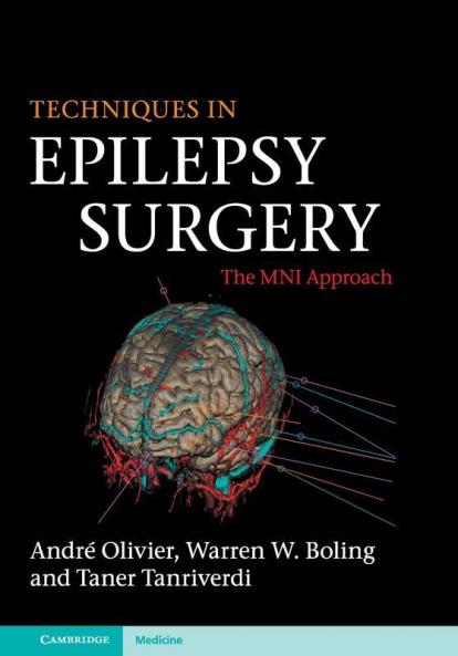 Techniques in Epilepsy Surgery