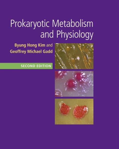 Prokaryotic Metabolism and Physiology
