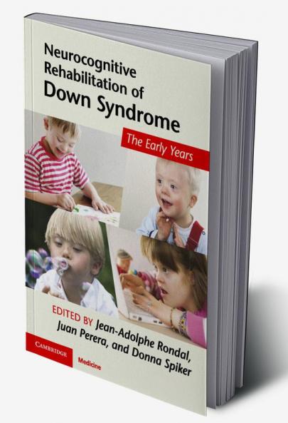 Neurocognitive Rehabilitation of Down Syndrome