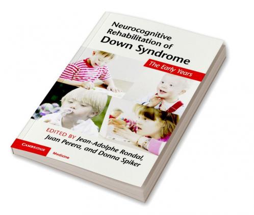 Neurocognitive Rehabilitation of Down Syndrome