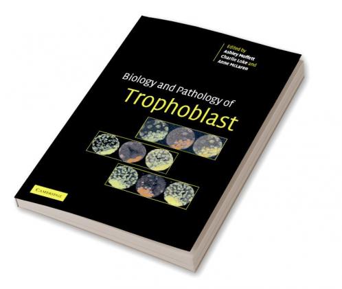 Biology and Pathology of Trophoblast