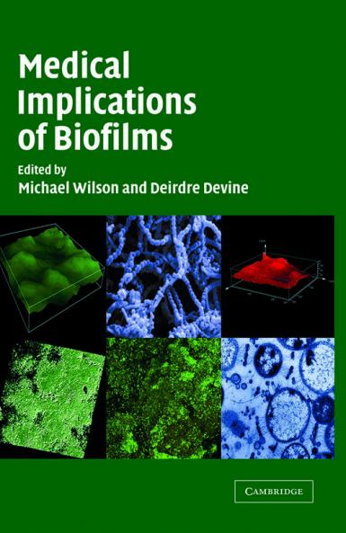 Medical Implications of Biofilms