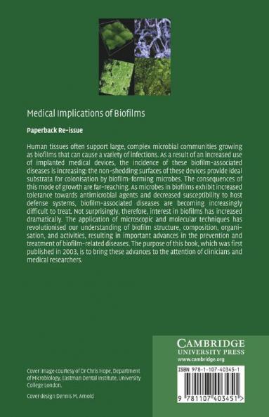 Medical Implications of Biofilms