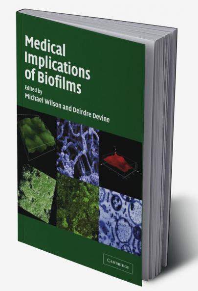 Medical Implications of Biofilms
