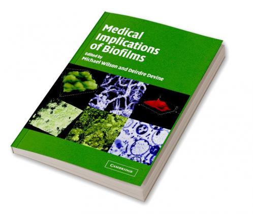 Medical Implications of Biofilms