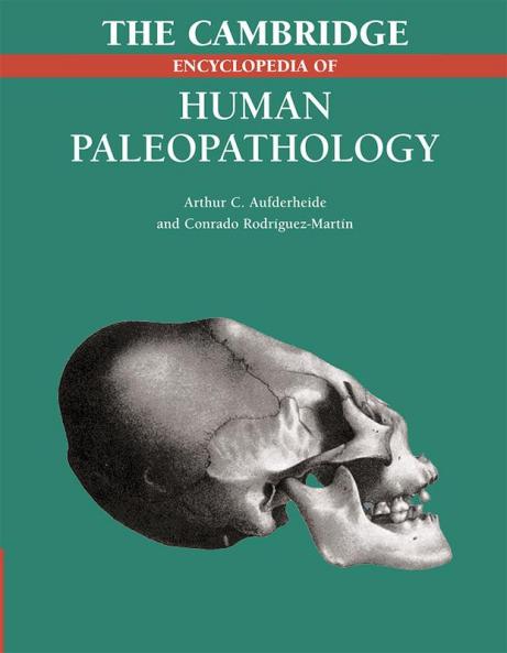 The Cambridge Encyclopedia of Human Paleopathology