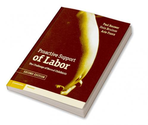 Proactive Support of Labor