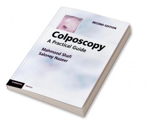 Colposcopy