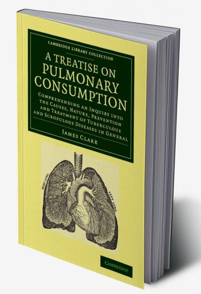 A   Treatise on Pulmonary Consumption