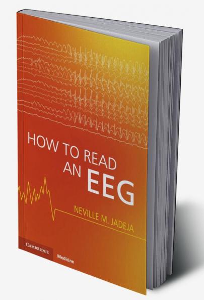 How to Read an Eeg