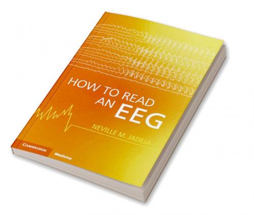 How to Read an Eeg