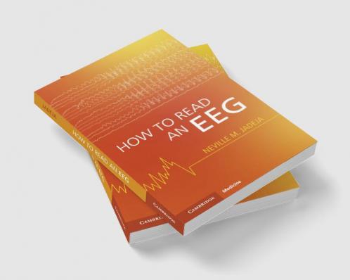 How to Read an Eeg