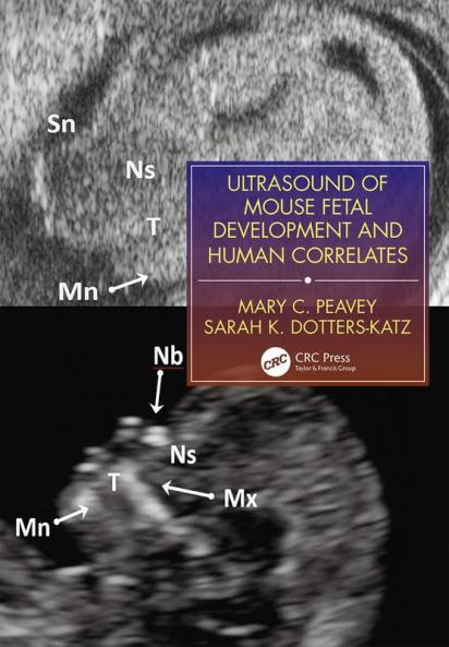 Ultrasound of Mouse Fetal Development and Human Correlates