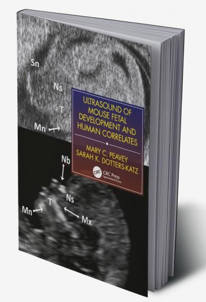 Ultrasound of Mouse Fetal Development and Human Correlates