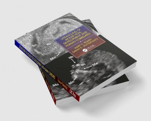 Ultrasound of Mouse Fetal Development and Human Correlates