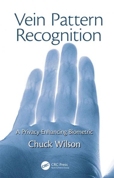 Vein Pattern Recognition