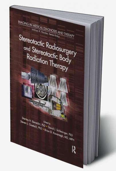 Stereotactic Radiosurgery and Stereotactic Body Radiation Therapy