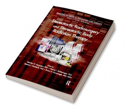 Stereotactic Radiosurgery and Stereotactic Body Radiation Therapy