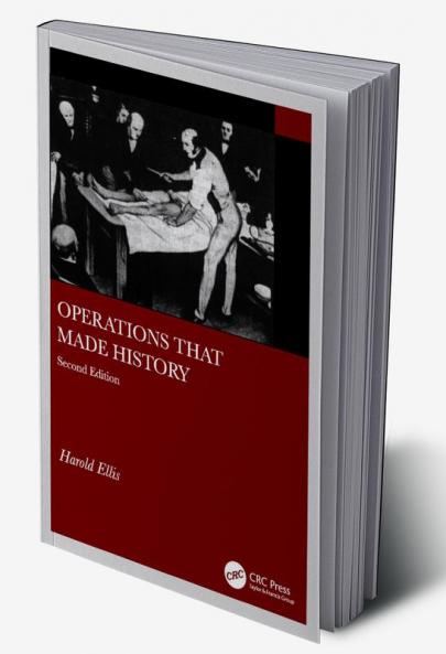 Operations that made History 2e