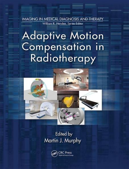 Adaptive Motion Compensation in Radiotherapy