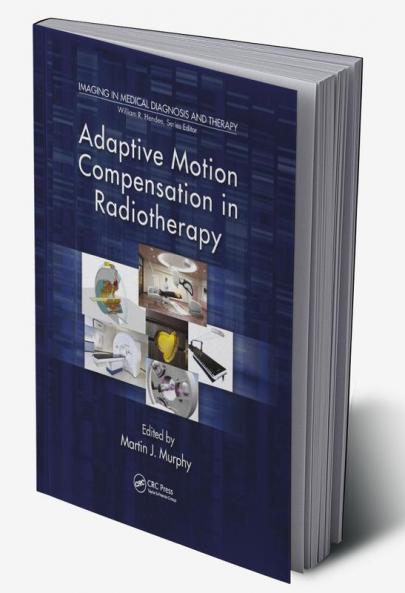 Adaptive Motion Compensation in Radiotherapy