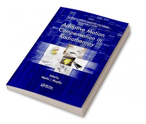 Adaptive Motion Compensation in Radiotherapy