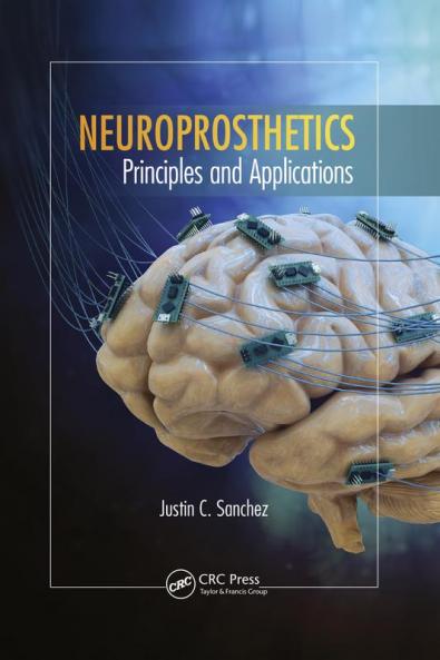 Neuroprosthetics