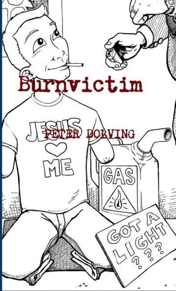 Burnvictim