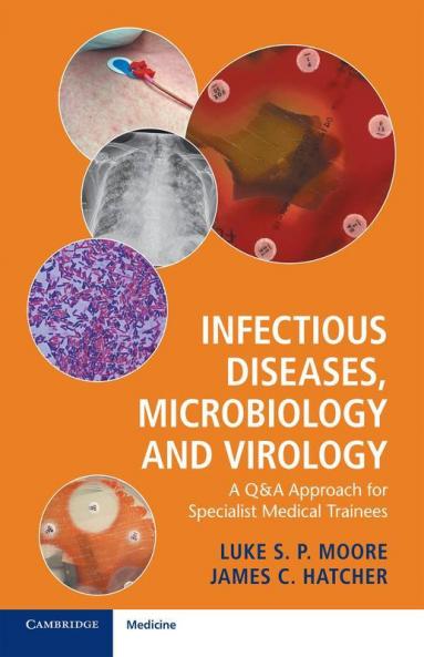 Infectious Diseases Microbiology and Virology