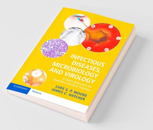 Infectious Diseases Microbiology and Virology