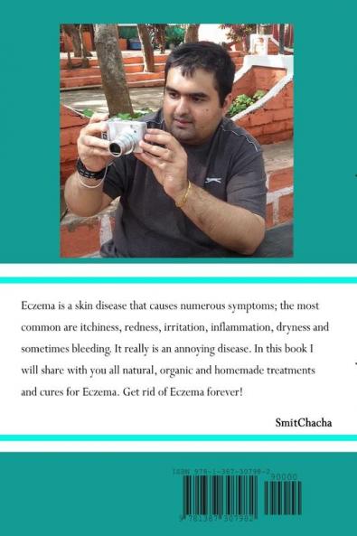 Eczema Cure Today - Get rid of Eczema forever natural ways to cure Eczema