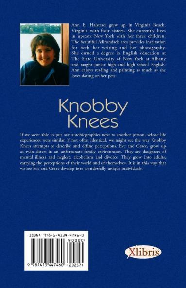 Knobby Knees