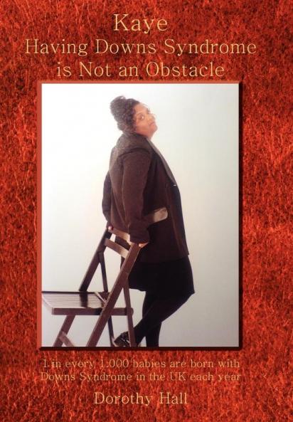 Kaye Having Downs Syndrome Is Not an Obstacle