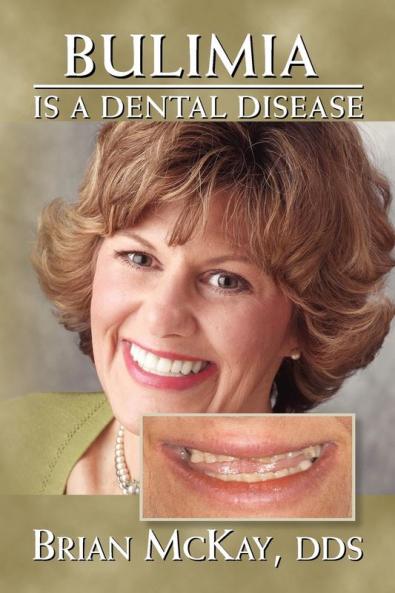 Bulimia Is a Dental Disease