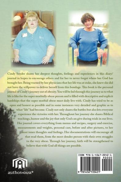 My Journey Out of Super Morbid Obesity