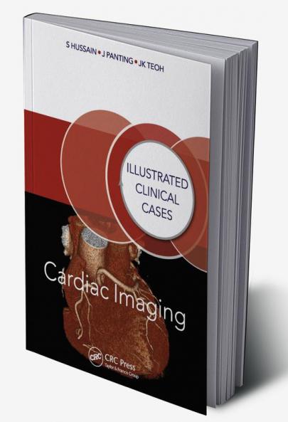 Cardiac Imaging